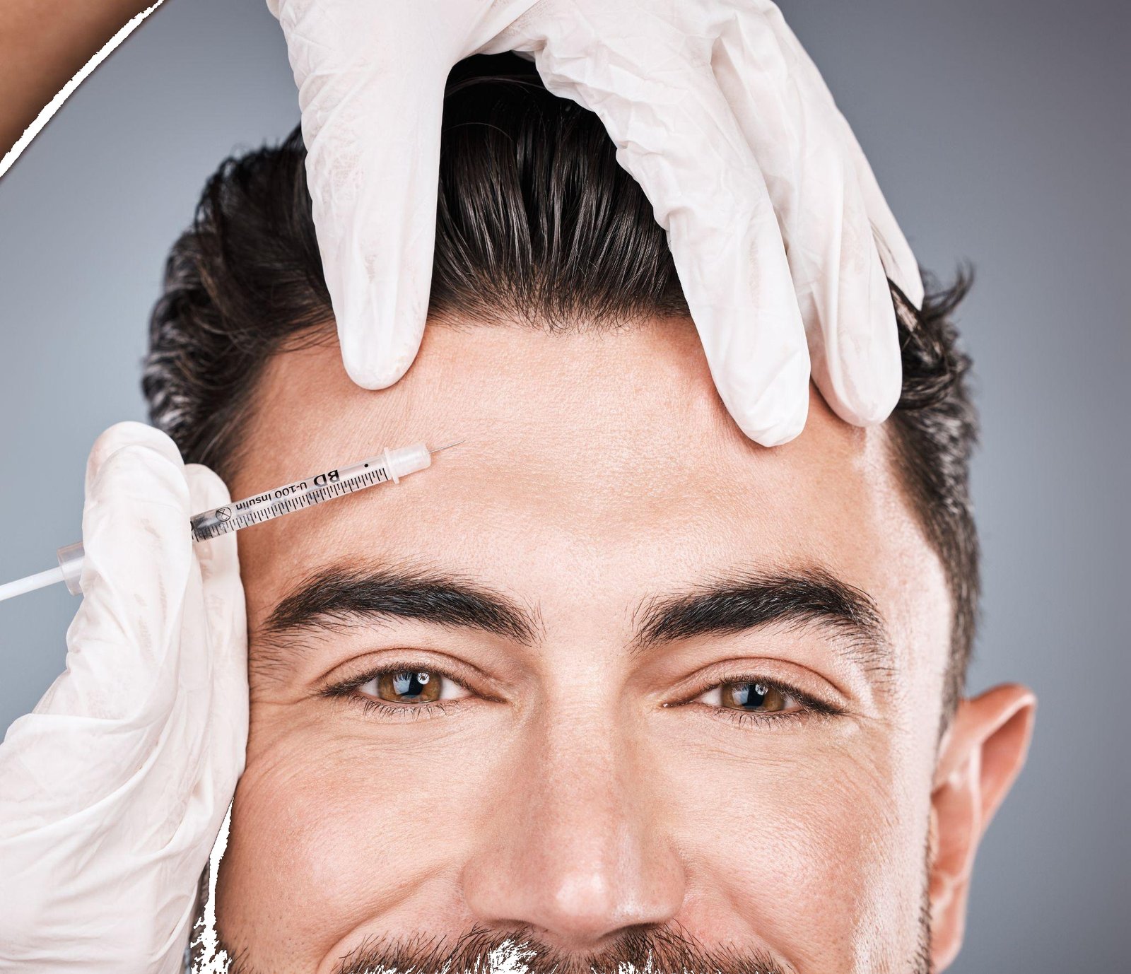 Botulinetoxine behandeling voorhoofd