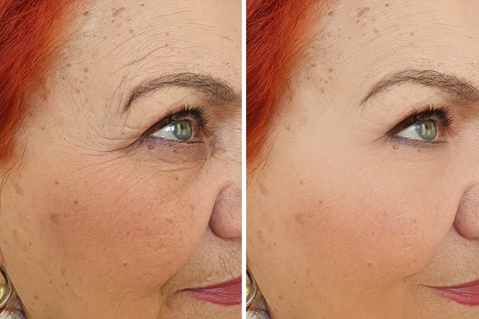 Face Care Clinic Filler Botox 10