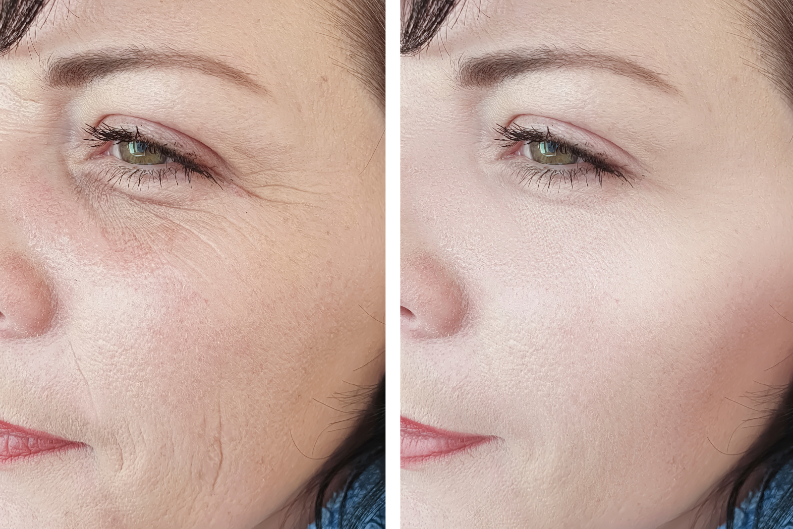 Face Care Clinic Filler Botox 9