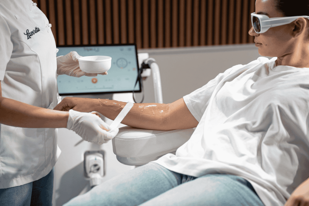 Laser ontharen Venlo