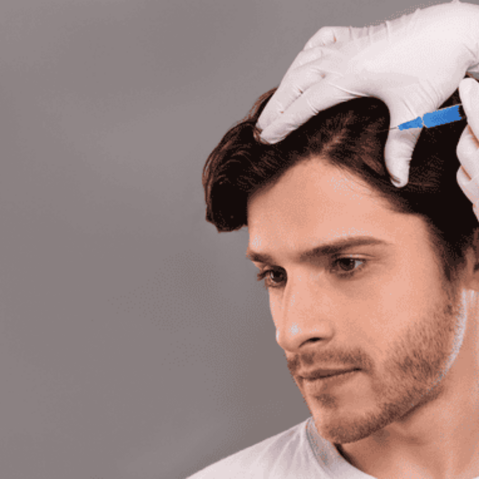 PRP haarverdunning behandeling