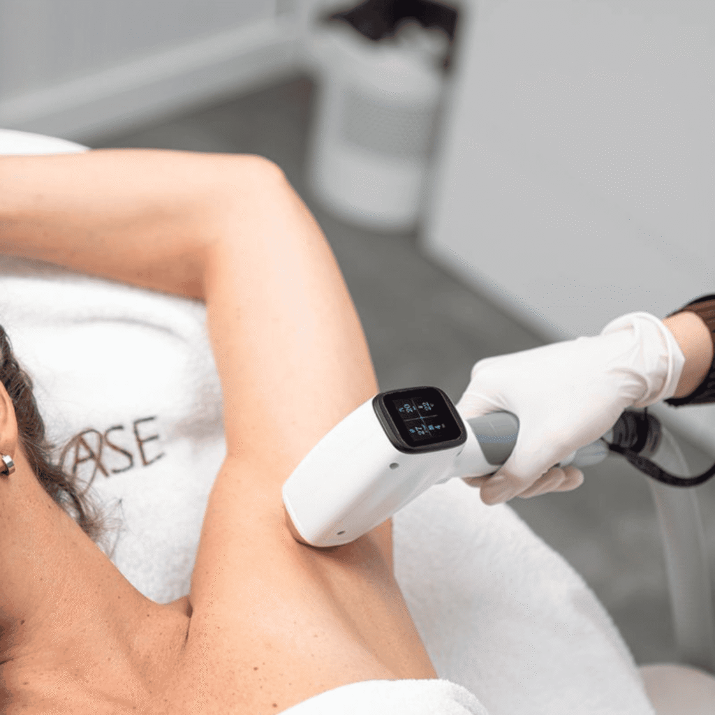 Laser ontharen oksels behandeling bij kliniek in Venlo