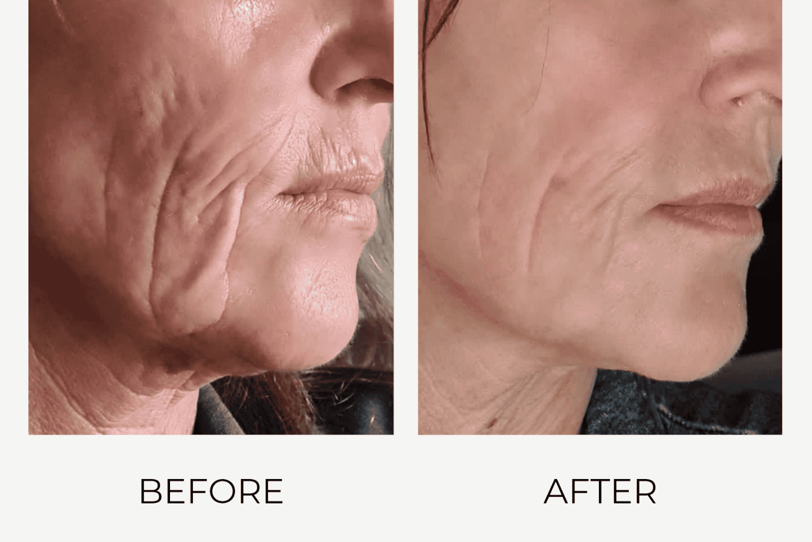 Voor en na foto van verbeterde huidtextuur en gladdere huid dankzij Craith Lab huidverzorging.