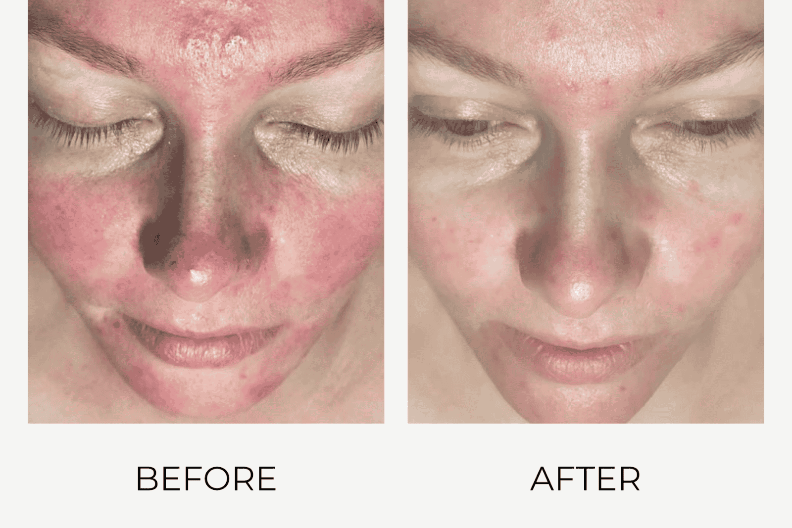 Voor en na foto van zichtbare huidverjonging met Craith Lab skincare met een egalere teint en gezonde uitstraling.