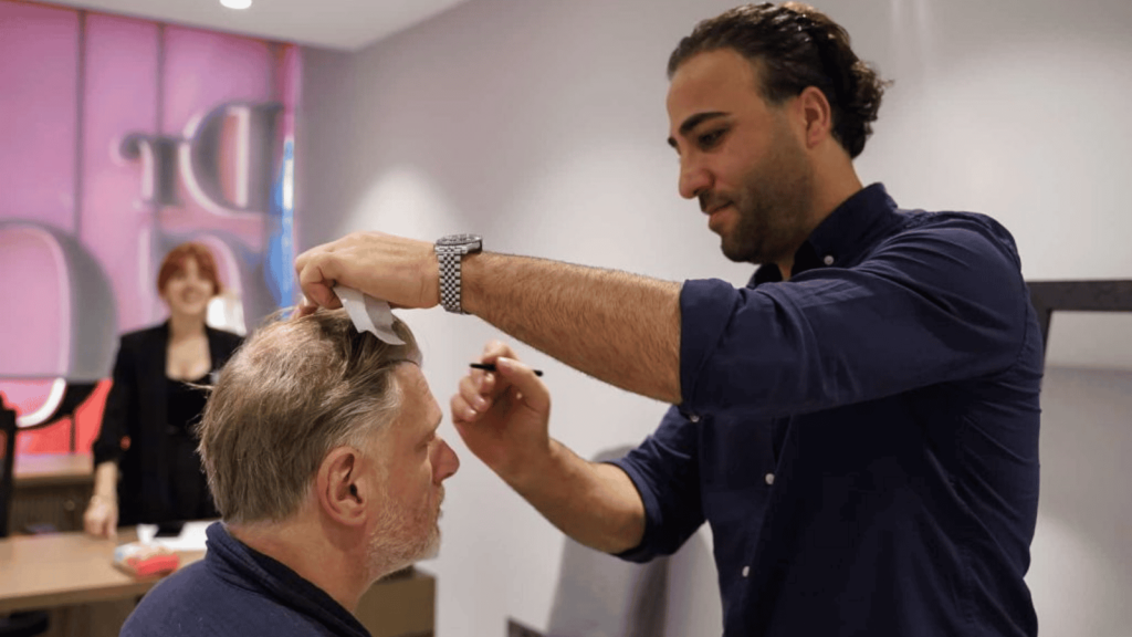 haartransplantatie nederland