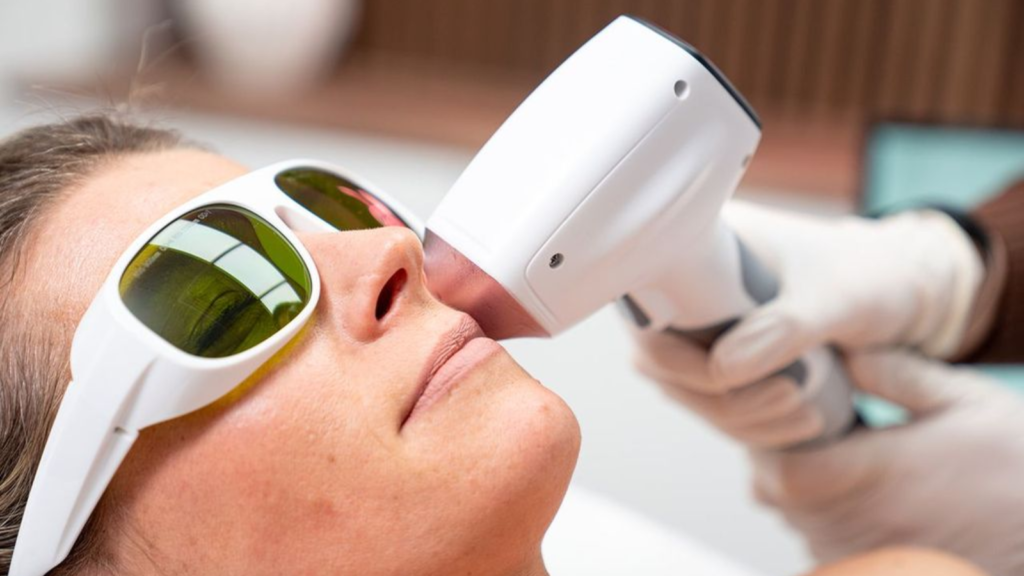 Veiligheid laser omtharen